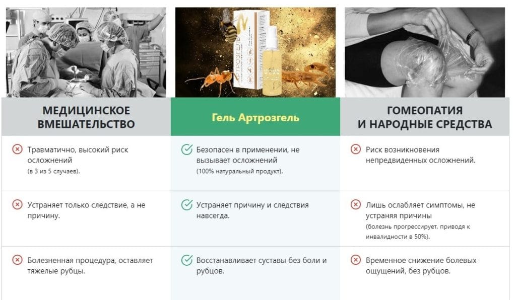 Артрозгель для суставов как помогает