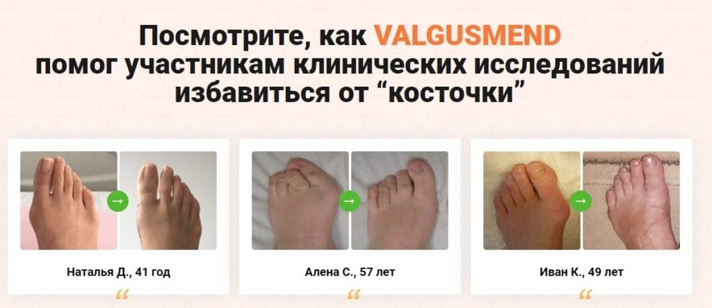 Valgusmend ΠΎΡ ΠΊΠΎΡΡΠΎΡΠΊΠΈ Π½Π° ΡΡΠΎΠΏΠ΅ ΠΎΡΠ·ΡΠ²Ρ