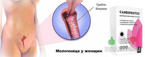 грибковая инфекция