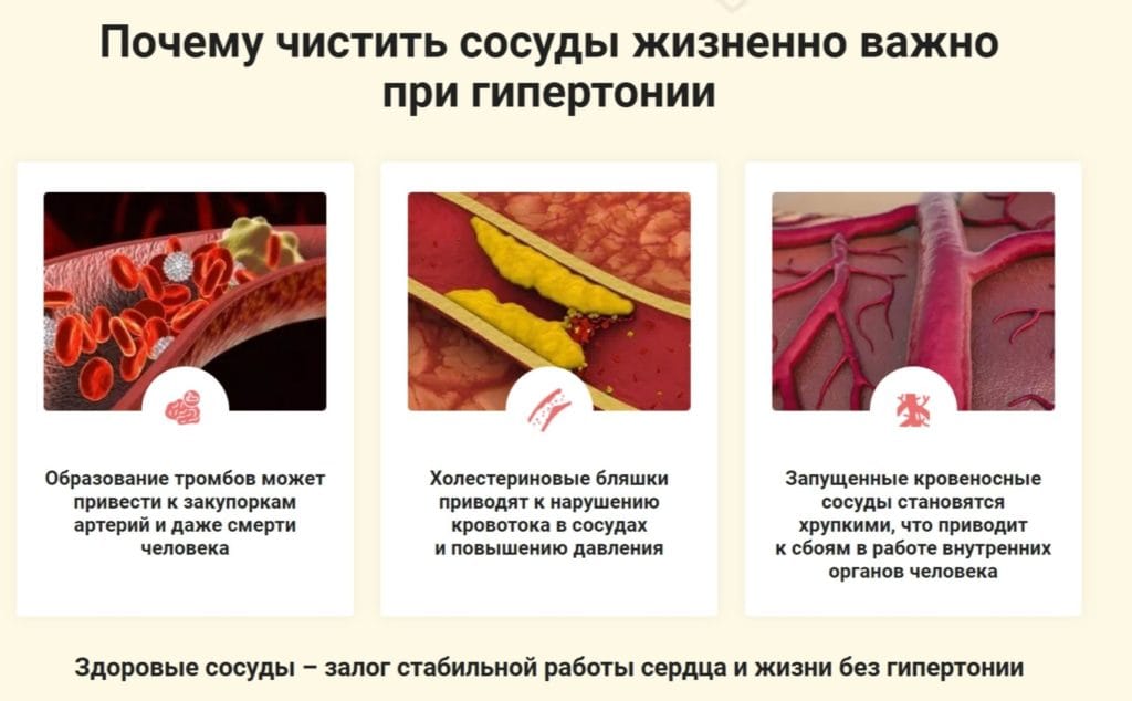 Cardiosoft от гипертонии