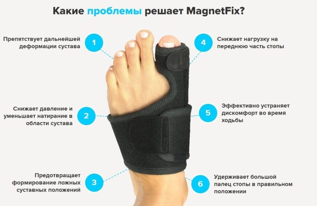 Вальгусная шина MagnetFix как действует