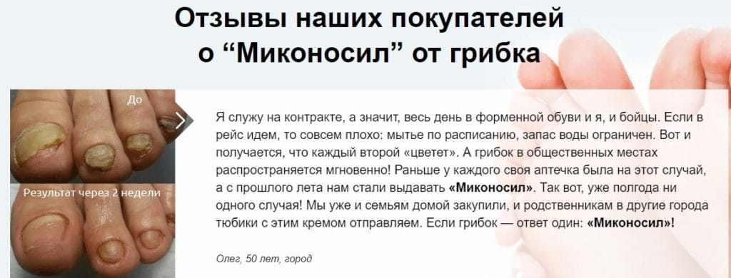 ΠΠΈΠΊΠΎΠ½ΠΎΡΠΈΠ» ΠΠ΅ΡΠΈΠ΄ΠΈΠ°Π½ ΠΎΡ Π³ΡΠΈΠ±ΠΊΠ° ΠΎΡΠ·ΡΠ²Ρ