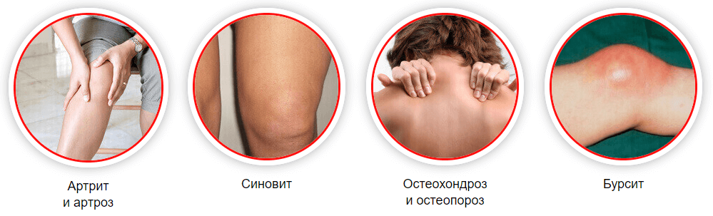 Гель Диклен для суставов от чего