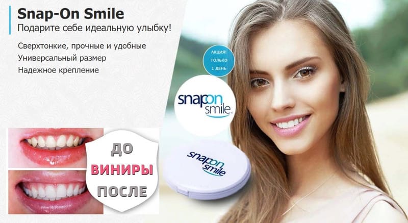 SNAP ON SMILE съёмные виниры