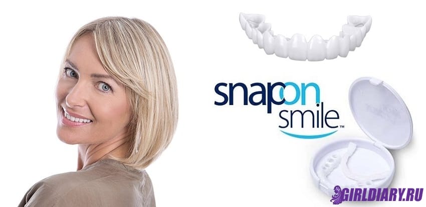 🥇Виниры Snap On Smile идеальная улыбка или развод покупателя, где ...