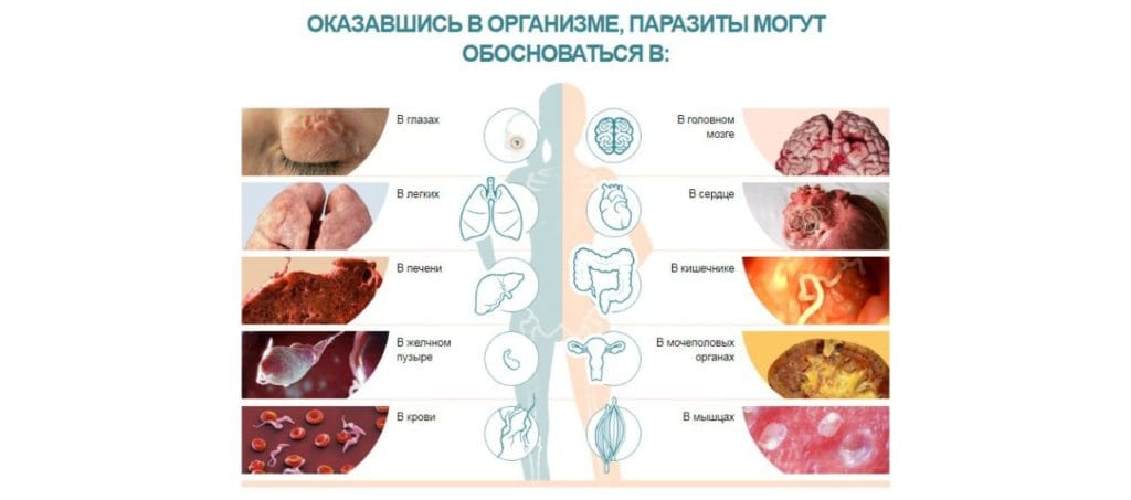 Π’ΠΎΠΊΡΠΈΠΏΠΎΠ» ΠΎΡ ΠΏΠ°ΡΠ°Π·ΠΈΡΠΎΠ²