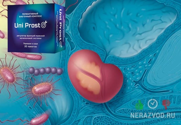 Uni Prost от воспаления простаты