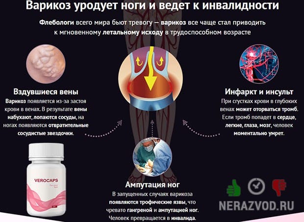 Верокапс препарат от варикоза