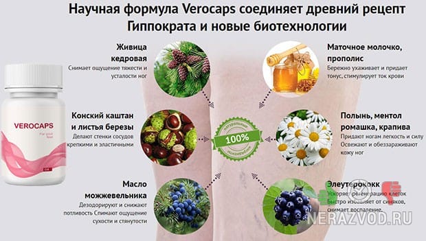 Варикоз