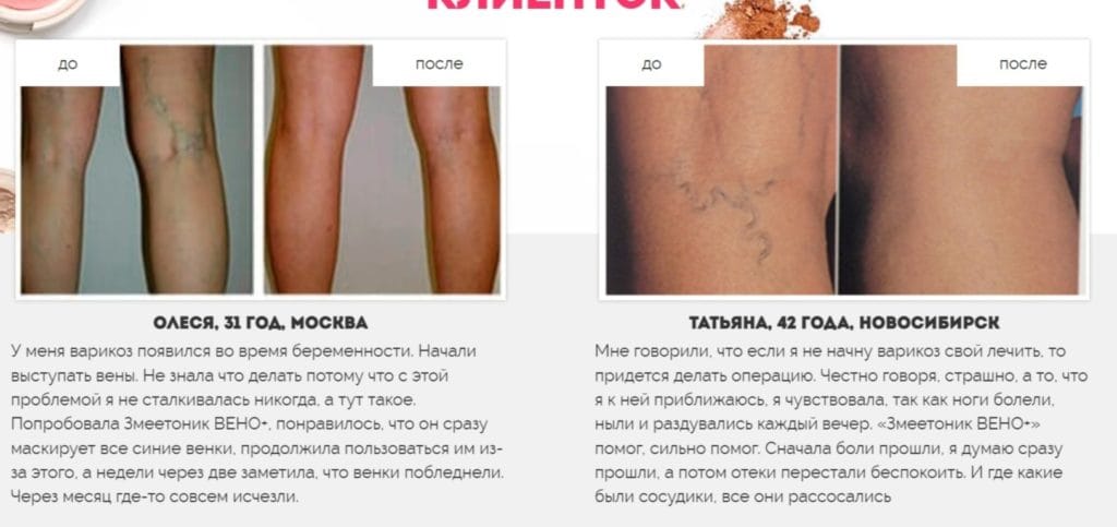 Змеетоник Вено Плюс - отзывы реальных покупателей